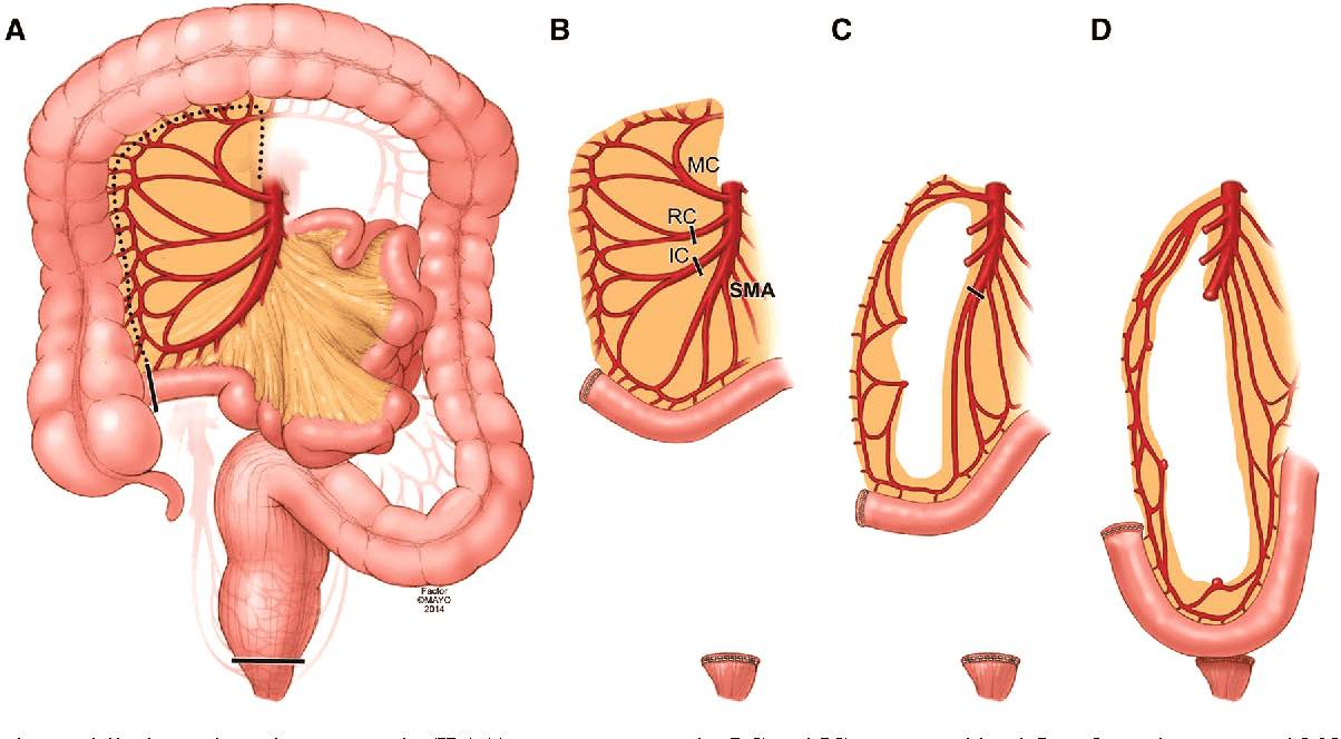 2-Figure1-1