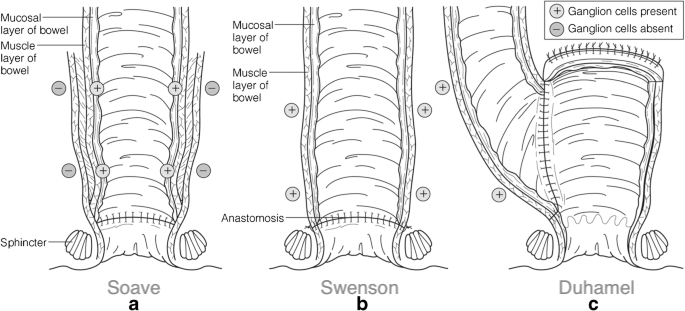 40746_2020_195_Fig2_HTML